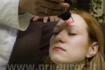 NEW! Plastic surgery in Palanga! ONLY IN SANATORIUM GRADIALI THE NEWEST AND UNIQUE LASER ASCLEPION DERMABLATE MCL 31!
